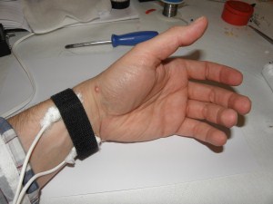 Wrist electrodes for Bob Beck blood electrification device