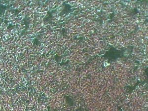 blood electrification under microscope before using Bob Beck blood electrification device